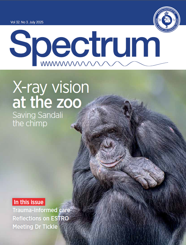 The July 2025 front cover of Spectrum magazine.